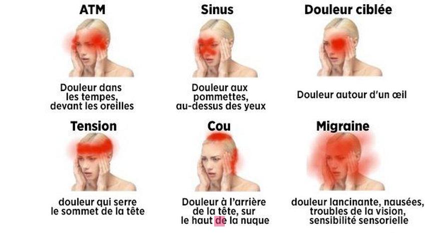 Mal de tête côté gauche au-dessus de l'oreille : Causes, symptômes et traitements à connaître