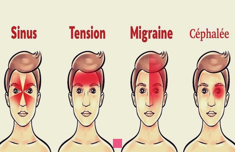 Mal de tête côté gauche chez l'homme : Signification, causes et ...